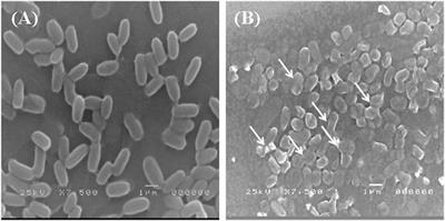 Draft genome analysis for Enterobacter kobei, a promising lead bioremediation bacterium